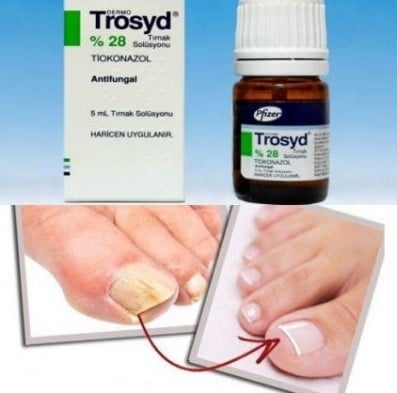 ТРОСИД TROSYD  Супер ефективен препарат срещу гъбички по ноктите 5мл.